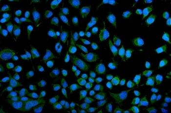 Immunofluorescent staining of FFPE human HeLa cells with KCNQ1 antibody (green) and DAPI nuclear stain (blue). HIER: steam section in pH6 citrate buffer for 20 min.