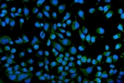 Immunofluorescent staining of FFPE human HeLa cells with KCNQ1 antibody (green) and DAPI nuclear stain (blue). HIER: steam section in pH6 citrate buffer for 20 min.