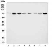 Western blot testing of 1) human U937, 2) human ThP-1, 3) rat stomach, 4) rat lung, 5) rat PC-12, 6) mouse stomach, 7) mouse lung and 8) mouse NIH 3T3 cell lysate with KCNQ1 antibody. Predicted molecular weight ~75/61 kDa (isoforms).