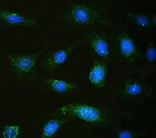 Immunofluorescent staining of FFPE human U-2 OS cells with Calpastatin antibody (green) and DAPI nuclear stain (blue). HIER: steam section in pH6 citrate buffer for 20 min.