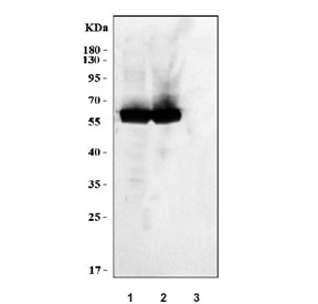 Western blot testing of human 1) A431, 2) HaCaT and 3) MCF7 cell lysate with Cytokeratin 5 antibody. Predicted molecular weight: 58-62 kDa.