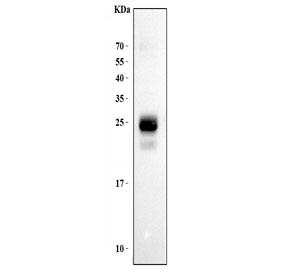 Western blot testing of human Jurkat lysate with HLA-DPB1 antibody at 0.5ug/ml.