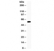 Western blot testing of 22RV1 cell lysate (prostate carcinoma) with CYP17A1 antibody at 0.5ug/ml. Predicted molecular weight ~57 kDa.