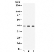 Western blot testing of 1) rat spleen, 2) mouse liver and 3) human A549 cell lysate with TAT antibody at 0.5ug/ml. Expected molecular weight 45-50 kDa.