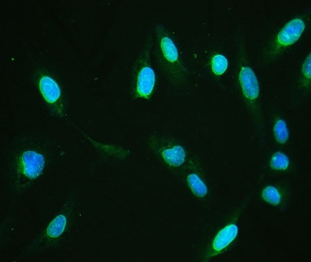 IF/ICC staining of FFPE human U-2 OS with Emerin antibody (green) at 1ug/ml and DAPI nuclear stain (blue). HIER: boil tissue sections in pH6, 10mM citrate buffer, for 10-20 min and allow to cool before testing.