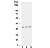 Western blot testing of 1) rat skeletal muscle, 2) mouse heart and 3) human HeLa lysate with Emerin antibody at 0.5ug/ml. Predicted molecular weight 29 kDa but routinely observed at ~34 kDa.