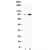 Western blot testing of 1) rat skeletal muscle and 2) human HepG2 cell lysate with Fibrinogen alpha chain antibody at 0.5ug/ml. Predicted molecular weight ~95 kDa (alpha-E isoform).