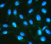 Immunofluorescent staining of FFPE human U-2 OS cells with IKKG antibody (green) and DAPI nuclear stain (blue). HIER: steam section in pH6 citrate buffer for 20 min.