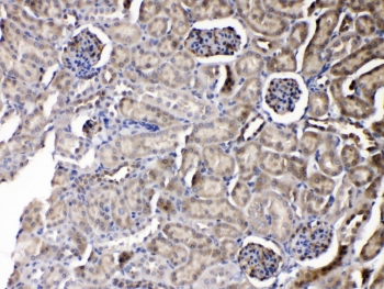 IHC testing of FFPE mouse kidney tissue with Purine nucleoside phosphorylase antibody at 1ug/ml. HIER: steam section in pH6 citrate buffer for 20 min.
