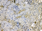IHC testing of FFPE rat kidney tissue with Purine nucleoside phosphorylase antibody at 1ug/ml. HIER: steam section in pH6 citrate buffer for 20 min.