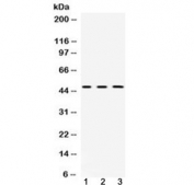 Western blot testing of 1) rat brain, 2) mouse brain and 3) human HeLa lysate with CNPase antibody at 0.5ug/ml. Predicted molecular weight ~47 kDa.