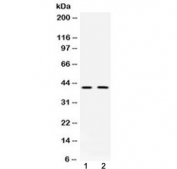 Western blot testing of 1) rat brain and 2) mouse brain with DCX antibody at 0.5ug/ml. Predicted molecular weight: 40-50 kDa.