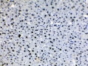 IHC testing of FFPE mouse liver tissue with HDGF antibody at 1ug/ml. HIER: steam section in pH6 citrate buffer for 20 min.