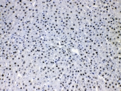 IHC testing of FFPE rat liver tissue with HDGF antibody at 1ug/ml. HIER: steam section in pH6 citrate buffer for 20 min.