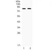 Western blot testing of 1) rat kidney and 2) human 22RV1 lysate with MUT antibody. Predicted molecular weight ~83 kDa.