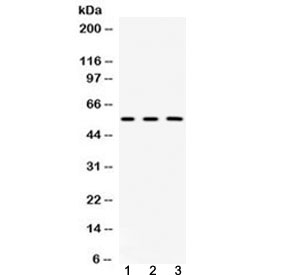 Western blot testing of 1) rat kidney, 2) mouse liver and 3) human HeLa lysate with Fibrinogen beta chain antibody at 0.5ug/ml. Predicted molecular weight ~56 kDa.~