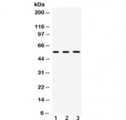Western blot testing of 1) rat kidney, 2) mouse liver and 3) human HeLa lysate with Fibrinogen beta chain antibody at 0.5ug/ml. Predicted molecular weight ~56 kDa.