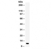 Western blot testing of human placenta lysate with DBI antibody at 0.5ug/ml. Predicted molecular weight ~10 kDa.