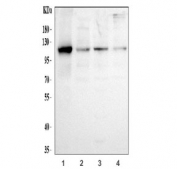 Western blot testing of human 1) U-87 MG, 2) HEL, 3) HepG2 and 4) RT4 cell lysate with Hexokinase II antibody at 0.5ug/ml.  Predicted molecular weight ~102 kDa.
