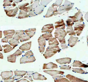 IHC staining of FFPE rat skeletal muscle tissue with Hexokinase II antibody. HIER: boil tissue sections in pH8 EDTA for 20 min and allow to cool before testing.