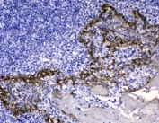 IHC testing of FFPE human tonsil tissue with Cytokeratin 14 antibody at 1ug/ml. HIER: steam section in pH6 citrate buffer for 20 min.