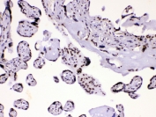 IHC testing of human placental tissue with hnRNP A1 antibody at 1ug/ml. HIER: steam section in pH6 citrate buffer for 20 min.