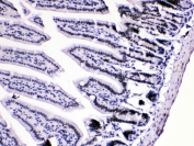 IHC testing of mouse intestine tissue with hnRNP A1 antibody at 1ug/ml. HIER: steam section in pH6 citrate buffer for 20 min.