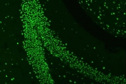 Immunofluorescent staining of FFPE mouse brain tissue with hnRNP A1 antibody. HIER: steam section in pH6 citrate buffer for 20 min.