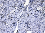 IHC testing of mouse kidney tissue with hnRNP A1 antibody at 1ug/ml. HIER: steam section in pH6 citrate buffer for 20 min.