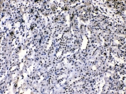 IHC testing of rat kidney tissue with hnRNP A1 antibody at 1ug/ml. HIER: steam section in pH6 citrate buffer for 20 min.