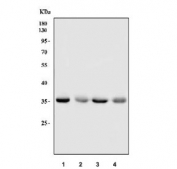 Western blot testing of human 1) HepG2, 2) Daudi, 3) MOLT4 and 4) HL60 cell lysate with hnRNP A1 antibody. Expected molecular weight: 29-39 kDa (multiple isoforms).