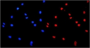 Immunofluorescent staining of FFPE human U-2 OS cells with hnRNP A1 antibody (red) and DAPI nuclear stain (blue). HIER: steam section in pH6 citrate buffer for 20 min.