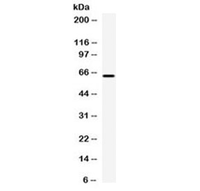 Western blot testing of human HepG2 cell lysate with Carboxypeptidase M antibody at 0.5ug/ml. Predicted molecular weight ~51 kDa but routinely observed at 58-65 kDa due to glycosylation.