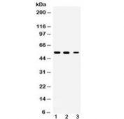 Western blot testing of 1) rat brain, 2) mouse brain and 3) human HeLa lysate with Beta III Tubulin antibody at 0.5ug/ml. Predicted molecular weight ~50 kDa.