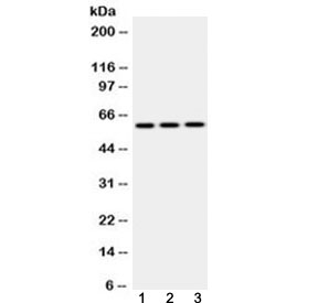 Western blot testing of 1) rat lung, 2) mouse lung and 3) HepG2 lysate with EPHX2 antibody at 0.5ug/ml. Predicted molecular weight: ~63/57 kDa (isoforms 1/2).~