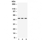 Western blot testing of 1) rat spleen, 2) mouse spleen and 3) human MCF7 lysate with DR4 antibody at 0.5ug/ml. Predicted molecular weight ~50 kDa.