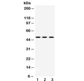 Western blot testing of 1) rat spleen, 2) mouse spleen and 3) human MCF7 lysate with DR4 antibody at 0.5ug/ml. Predicted molecular weight ~50 kDa.