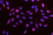 Immunofluorescent staining of FFPE human U-2 OS cells with DR4 antibody (red) and DAPI nuclear stain (blue). HIER: steam section in pH6 citrate buffer for 20 min.