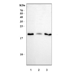 Western blot testing of human 1) 293T, 2) A549 and 3) K562 cell lysate with APRT