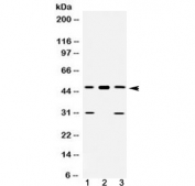 Western blot testing of 1) rat liver, 2) mouse heart and 3) human U-2 OS lysate with E2F3 antibody at 0.5ug/ml. Predicted molecular weight ~49 kDa.
