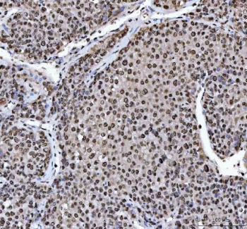 IHC staining of FFPE rat brain with hnRNP L antibody. HIER: boil tissue sections in pH6, 10mM citrate buffer, for 10-20 min and allow to cool before testing.