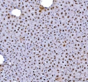 IHC staining of FFPE mouse liver tissue with hnRNP L antibody. HIER: boil tissue sections in pH8 EDTA for 20 min and allow to cool before testing.