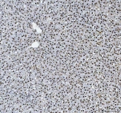 IHC staining of FFPE rat liver tissue with hnRNP L antibody. HIER: boil tissue sections in pH8 EDTA for 20 min and allow to cool before testing.