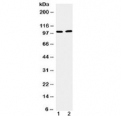 Western blot testing of 1) mouse testis and 2) human U-87 MG cell lysate with TACC1 antibody at 0.5ug/ml. Predicted molecular weight ~88 kDa but routinely observed at 100-125 kDa.