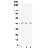 Western blot testing of 1) rat liver, 2) mouse spleen and 3) human HeLa cell lysate with hnRNP F antibody at 0.5ug/ml.  Predicted molecular weight ~46 kDa.