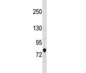 Western blot testing of human HepG2 cell lysate with ACSL3 antibody at 0.5ug/ml. Predicted molecular weight ~80 kDa.