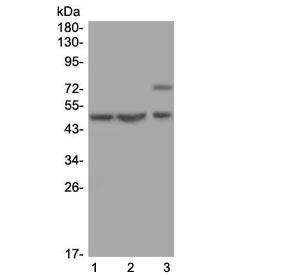 Western blot testing of 1) human U-2 OS, 2) human MCF7 and 3) rat kidney lysate with AP2M1 antibody at 0.5ug/ml. Predicted molecular weight ~50 kDa.