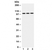 Western blot testing of 1) rat testis, 2) mouse brain and 3) human MCF7 cell lysate with AP2B1 antibody at 0.5ug/ml. Predicted molecular weight ~105 kDa.