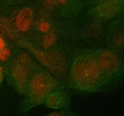 Immunofluorescent staining of FFPE human A431 cells with ST7 antibody (red) and Beta Tubulin mAb (green). HIER: steam section in pH6 citrate buffer for 20 min.