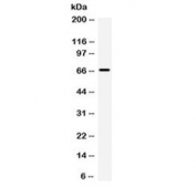 Western blot testing of human PANC cell lysate with ST7 antibody at 0.5ug/ml. Predicted molecular weight ~67 kDa.
